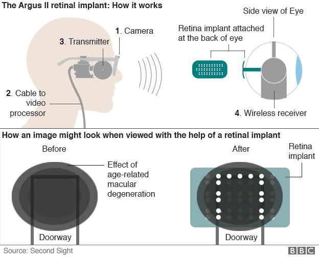 How the eye works