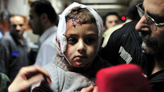 Injured Syrian boy at a hospital in Damascus. 21 Feb 2016