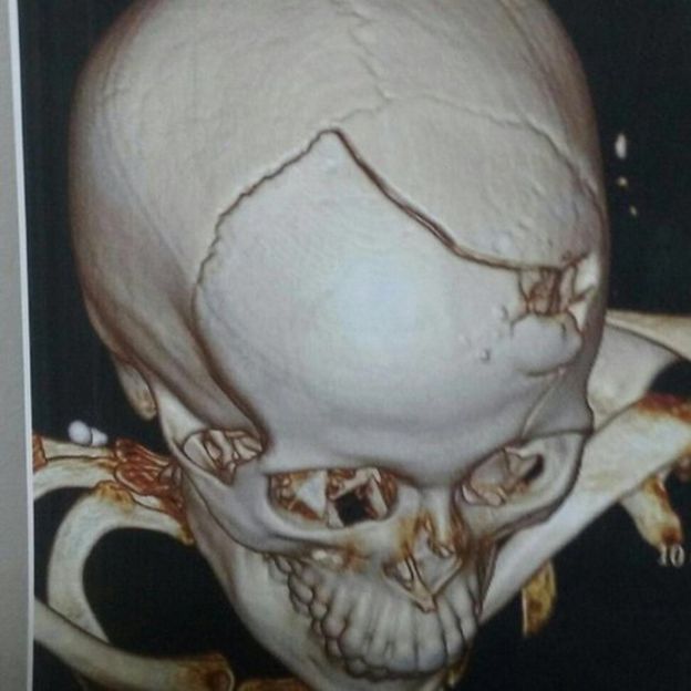 Ressonância magnética do crânio de Anna Paula Cotta