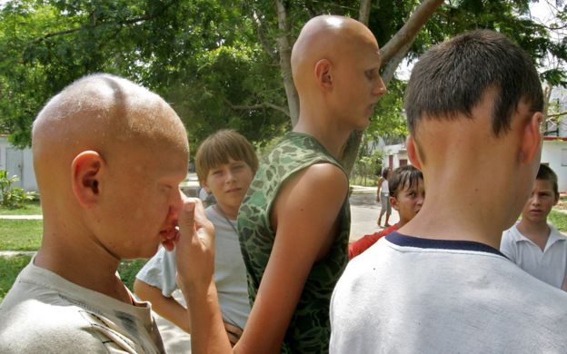 Παιδιά από την Ουκρανία, οι οποίοι είναι ασθενείς του Νοσοκομείου de Tarara, σε Tarara, Κούβα