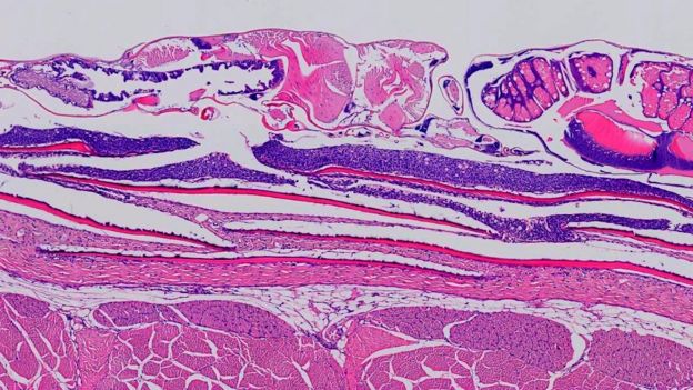 Biopsia