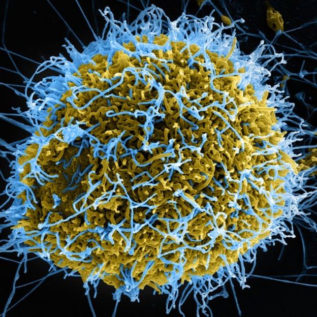 Virus de ébola ataca una célula