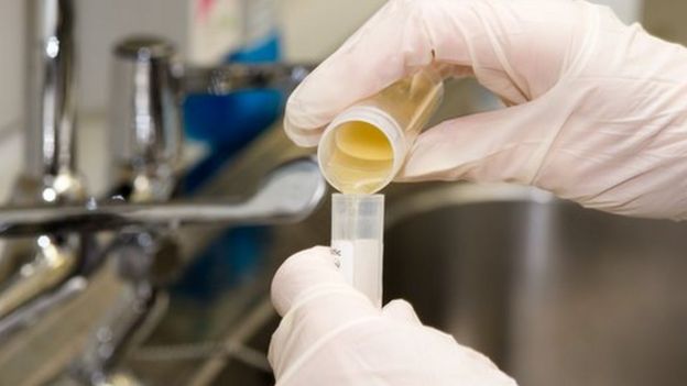 urine test