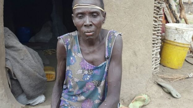 Nyakuich Both whose husband was killed in the attack on Lare village, Ethiopia, and her two children abducted
