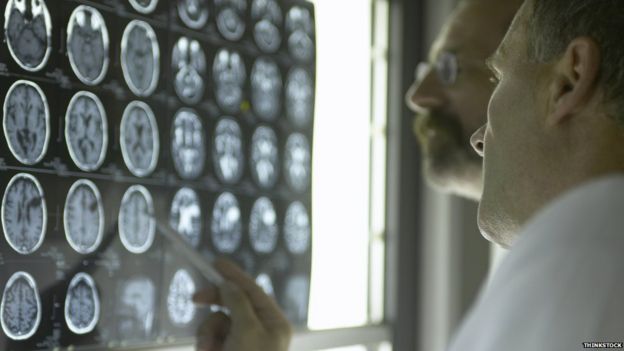 Radiografias de cérebro
