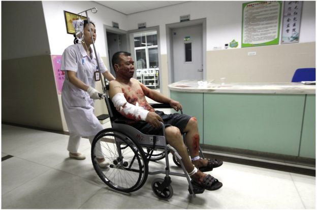 An injured man is assisted by a nurse at a hospital following treatment for his injuries after a series of blasts in Liucheng county in Liuzhou, south China's Guangxi province on 1 October 2015