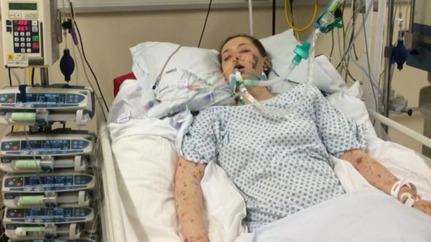 Charlene Colechin na maca do hospital