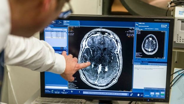 Scientists breach brain barrier to treat sick patient