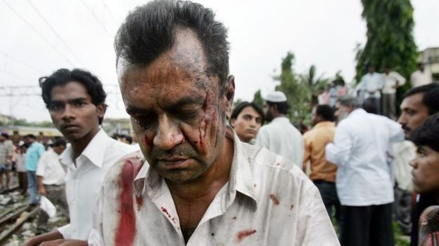 An unidentified person who was injured in a bomb blast at the Mahim railway station walks away from the site, in Bombay, India, Tuesday, July 11, 2006.