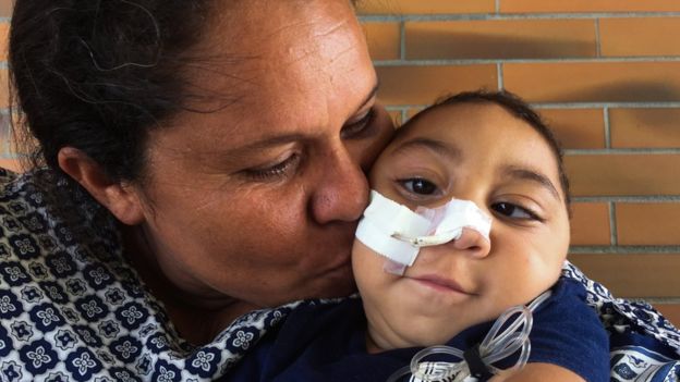 Solange Ferreira con su hijo Jose Wesley, afectado por el virus del Zika