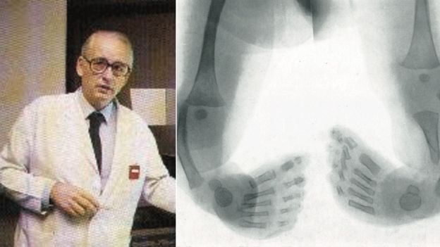 Dr Knapp and one of the X-ray plates