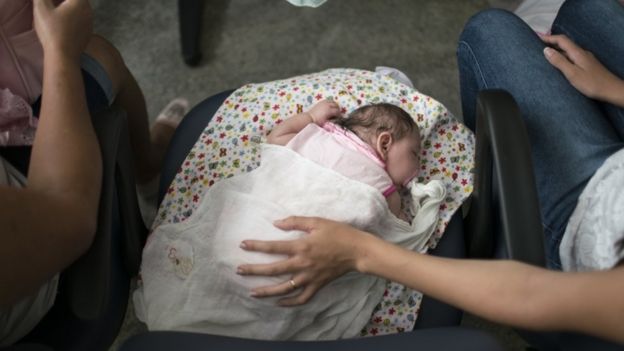 Braziliyada mikroselafiya ilə doğulan uşaqların sayı artır