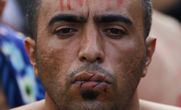 Migrant with lips sewn together