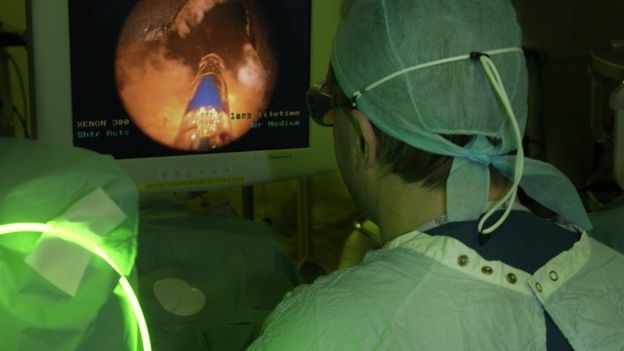 Green light laser being used in an operating theatre