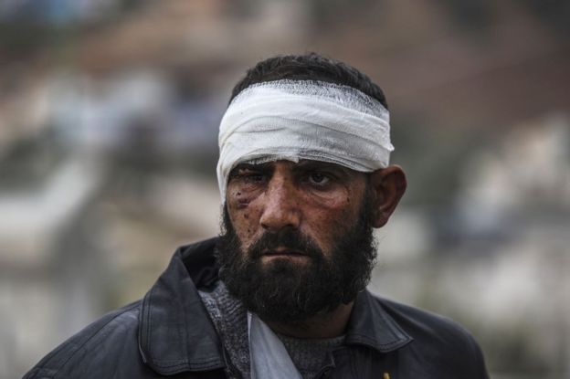 An injured Syrian man near the Turkish border, 16 December