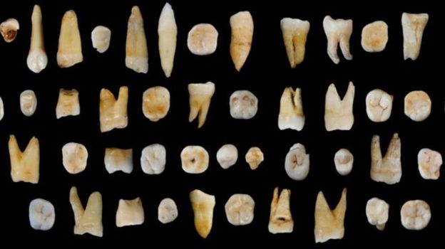 Daoxian teeth