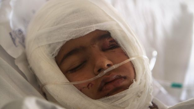 A 2012 file picture of a four-year-old boy who was bitten by a dog in Kashmir