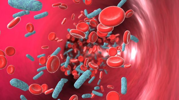 Suspected sepsis in patients must be treated as an emergency in the same way as heart attacks are, England's health watchdog says. ANIMATED HEALTHCARE LTD/SCIENCE PHOTO LIBRARY