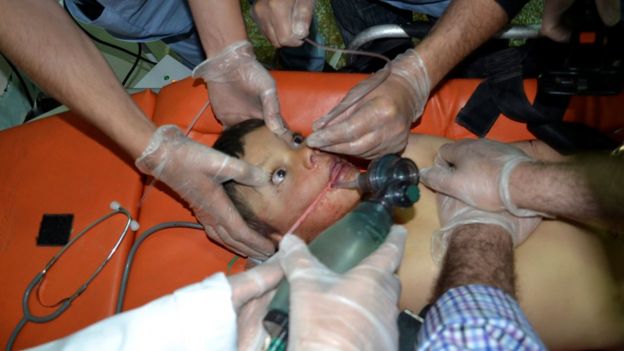 A boy who activists say was affected by a gas attack receives treatment at Bab al-Hawa hospital