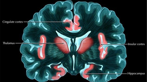 மூளையில் இன்சுலா பகுதி பல இணைப்புப் பகுதிகளை கொணடது.