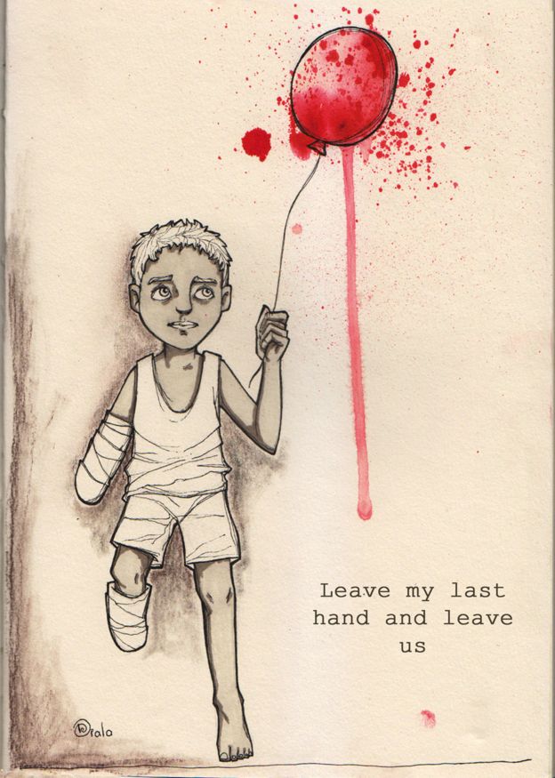Boy who has lost an arm and a leg holding a blood-spattered balloon