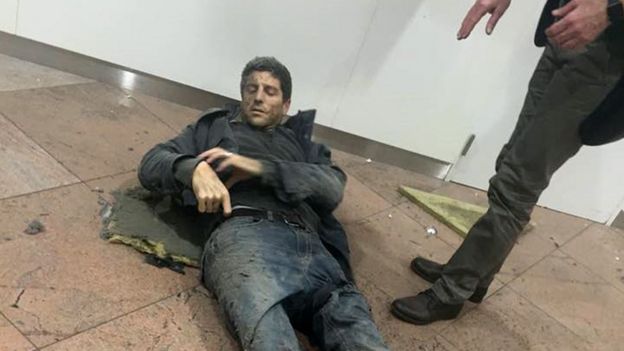 In this photo provided by Georgian Public Broadcaster and photographed by Ketevan Kardava a man is wounded in Brussels Airport in Brussels, Belgium, after explosions were heard Tuesday, March 22, 2016.