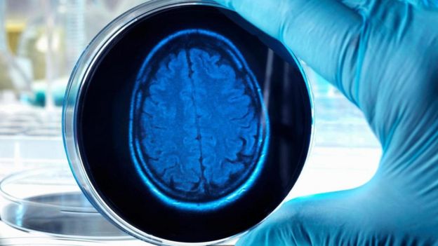 تطوير أدمغة مصغرة خارج الجسم
