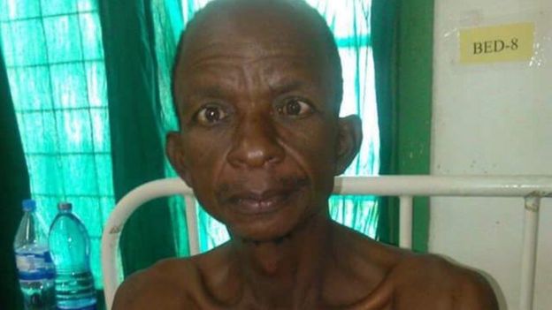Rescued miner at hospital in Tanzania (17 November 2015)