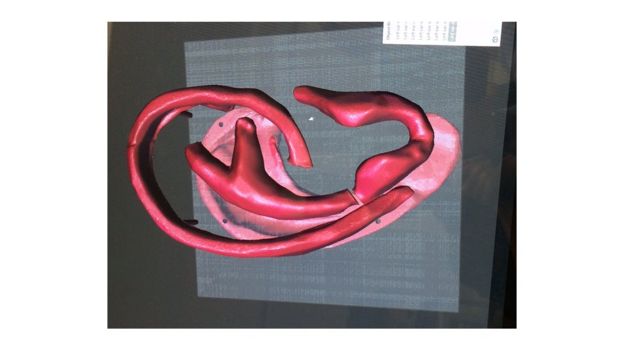 3D model of an ear