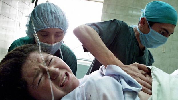 Enfermeros durante un parto.