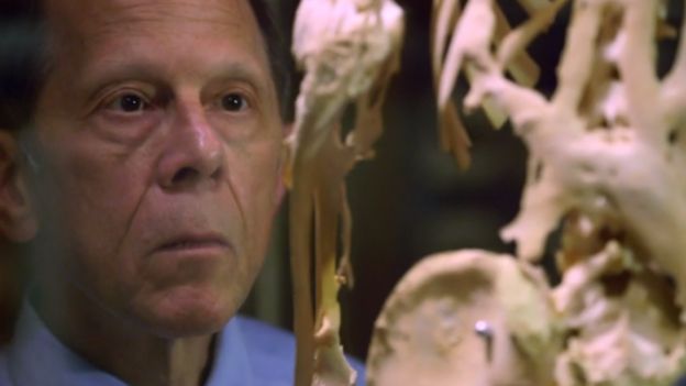 El doctor Kaplan observando el esqueleto de Harry Eastlack en el museo Mutter de Filadelfia.