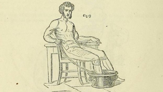 Un diagrama de un tratamiento para la pierna