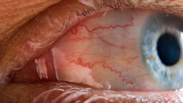 Ojo humano