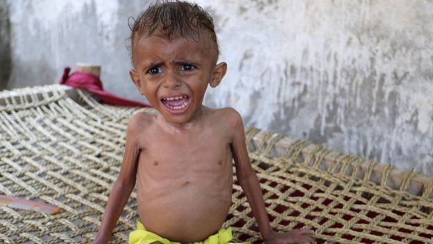 طفل يمني