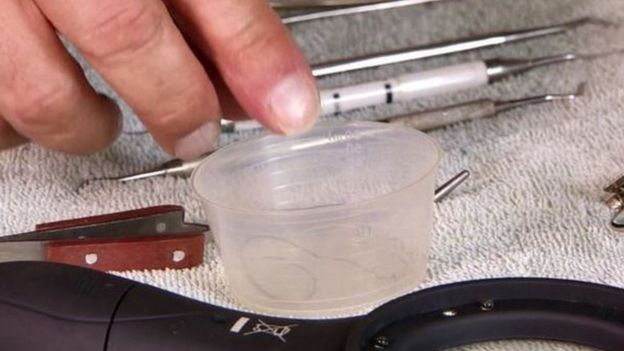 Los instrumentos que fabricó Graham Smith para poder quitarse a sí mismo la sutura interna de una operación anterior.