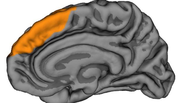brain diagram showing location of PCS