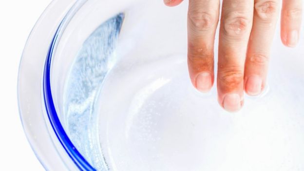 Una persona mete sus dedos con quemaduras en un bol de agua fría