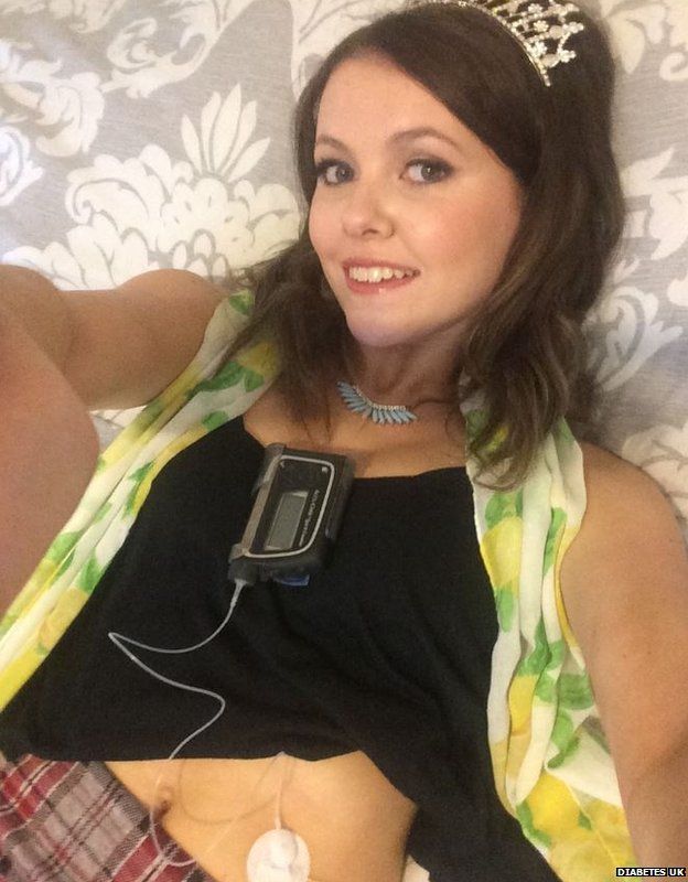 Diabetic Us Model Sierra Sandison Wears Insulin Pump Bbc Newsbeat