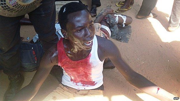 An injured man sits on the ground after a suicide blast in the north-eastern Nigerian town of Potiskum on 3 November 2014