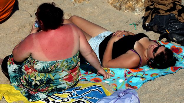 Sunburnt back on a beach in Cornwall, UK