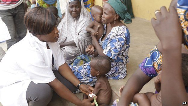 A doctor attends to a malnourished child as women and children rescued by Nigerian soldiers wait to receive treatment at a refugee camp in Yola, Nigeria Sunday, 3 May 2015