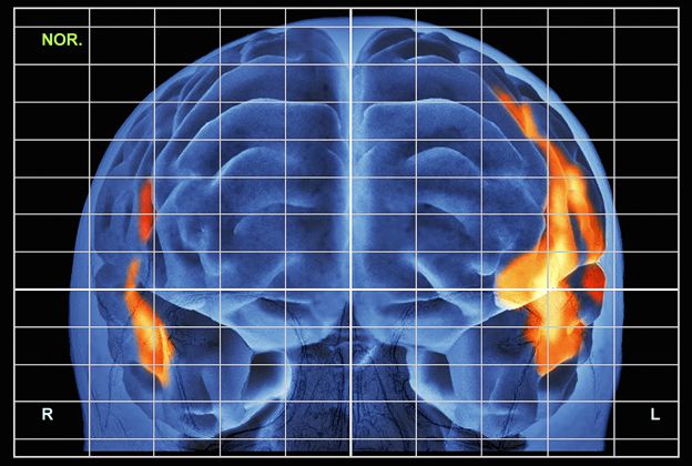 Scan showing brain activity while reading aloud.