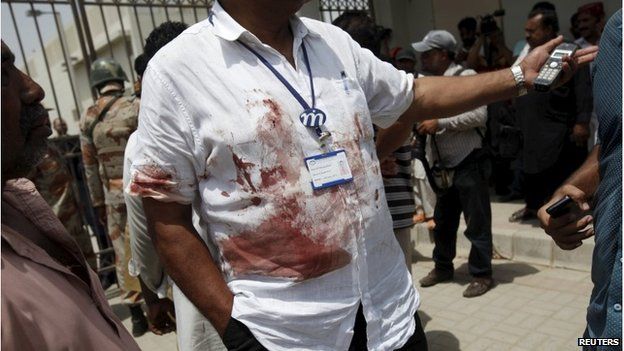 A hospital official wearing a blood stained shirt stands outside the hospital
