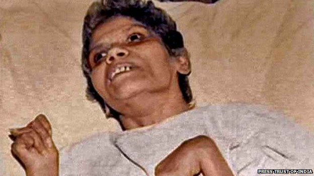 Aruna Shanbaug