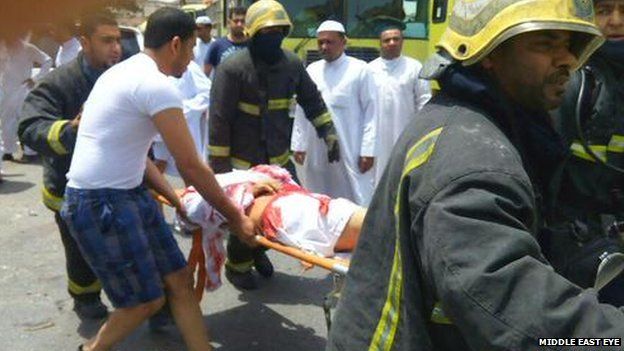 A casualty is stretchered away from Imam Ali mosque in al-Qadeeh, Saudi's Eastern Province, after a suicide bomber struck Friday prayers (image courtesy Middle East Eye)