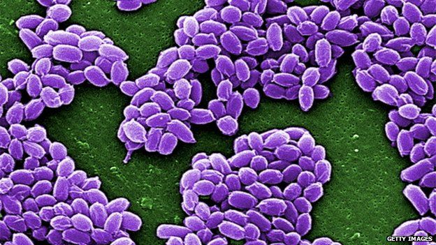 Deadly Anthrax under a microscope