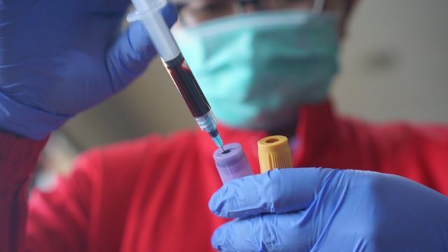 Virus Corona Metode Efektivitas Dan Pelaksanaan Rapid Test Covid