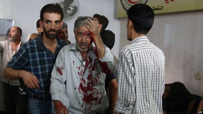 A man injured in Sunday's strike arrives at a makeshift hospital in Douma