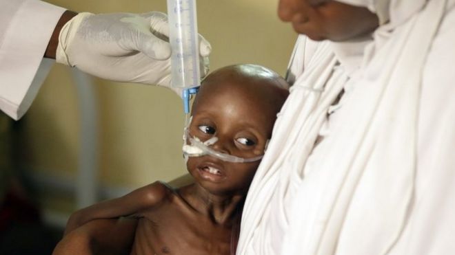 A malnourished child is fed in in Maiduguri, Nigeria's Borno state. Photo: August 2016