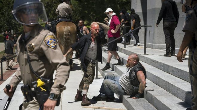 Wounded men sitting on steps of California State Capitol after members of right-wing extremist groups clashed with counter-protesters in Sacramento, Sunday, June 26, 2016